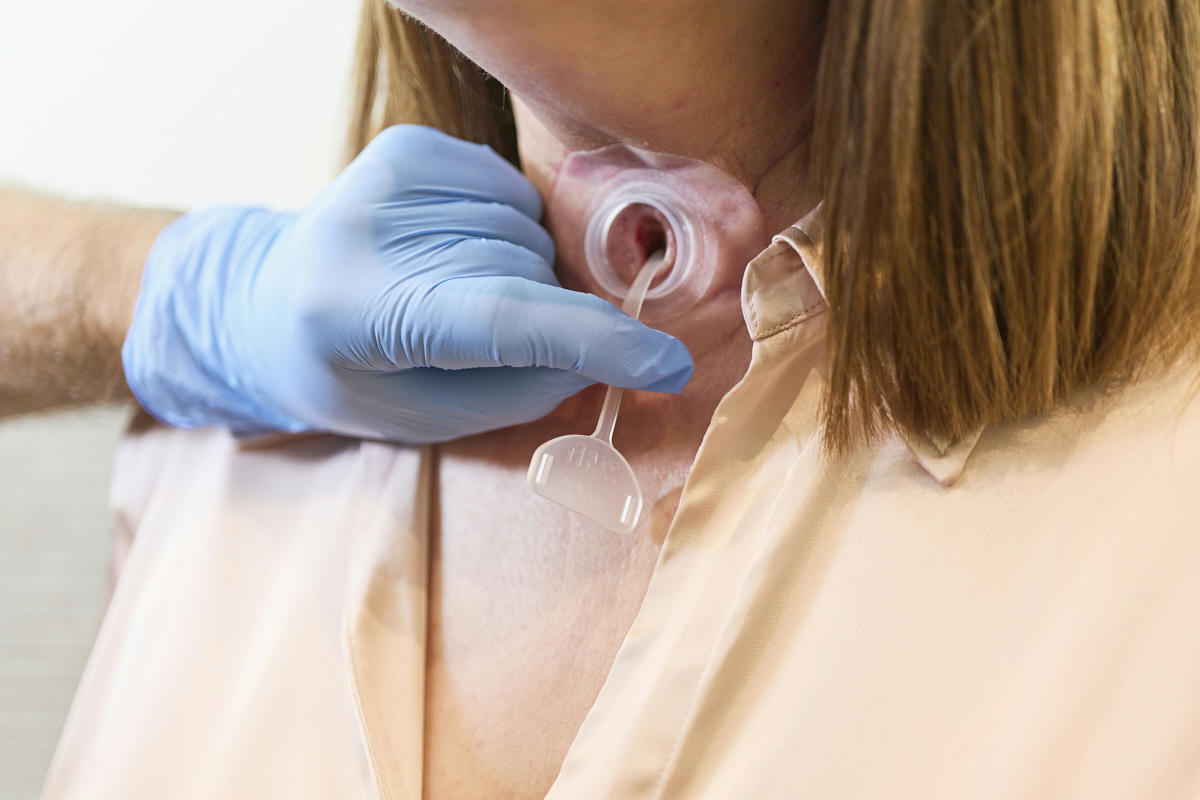Verwendung des Provox Plug - Atos Medical